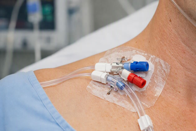 The hospital apologised to the patient and introduced further safeguards.
